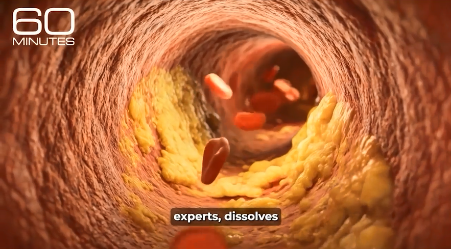 Diagram comparing a healthy artery to a narrowed artery